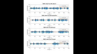 Simulated EMG based Hand Movement
