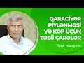 Qaraciyər piylənməsi və köp üçün təbii çarələr | Qaraciyər piylənməsinin müalicəsi 