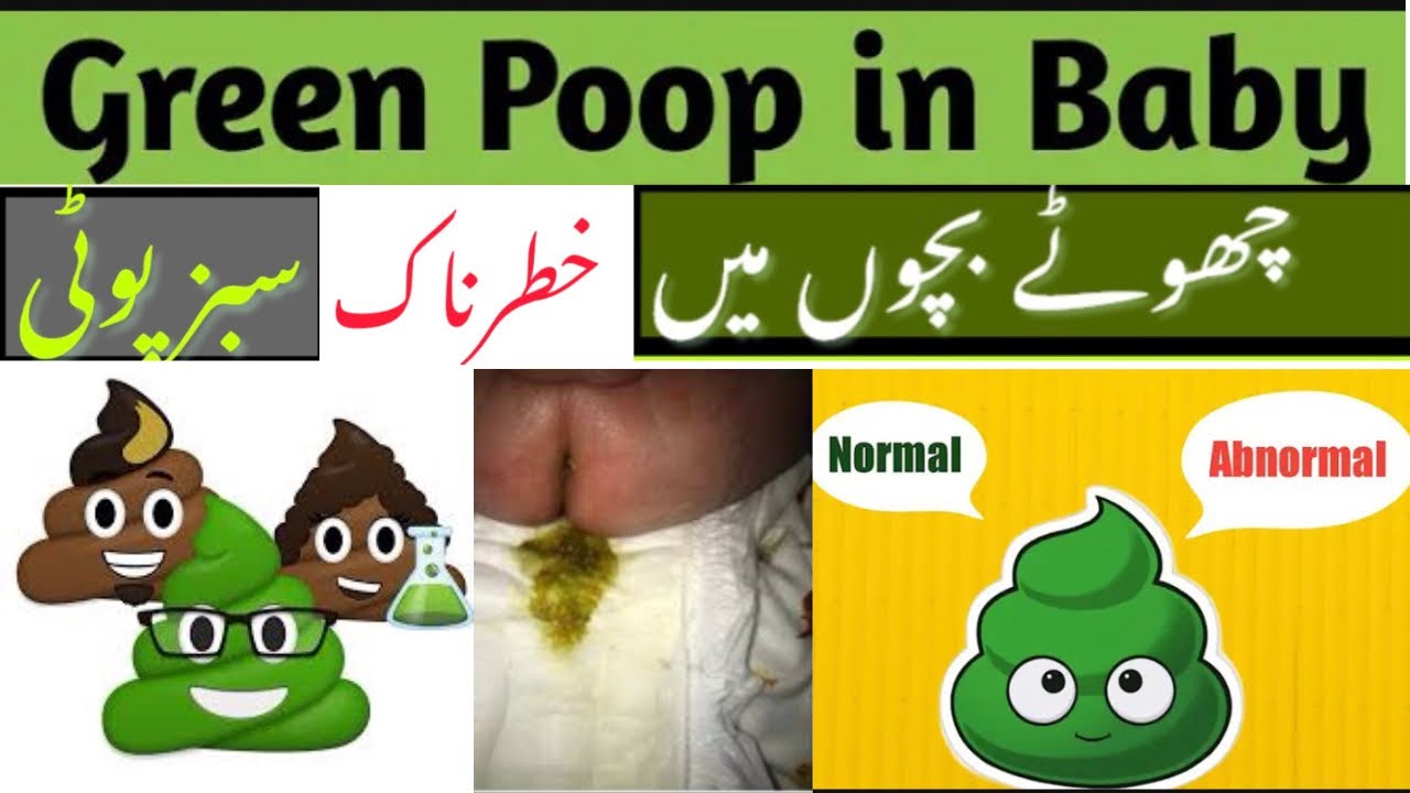 Why is Poop green in Kids 💩 سبز پوٹی बच्चों में हरा मल potty Urdu
