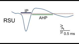Effects of TUS in in vivo Rodent Models with Bin He