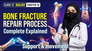 Bone Fracture Repair & Types of Fractures | Class 12 Biology Support & Movement‎ screenshot 4