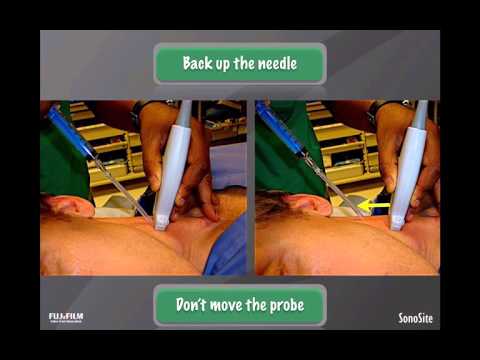 Image of Webinar: Procedural Guidance with Ultrasound in Emergency Medicine