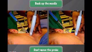 Webinar: Procedural Guidance with Ultrasound in Emergency Medicine