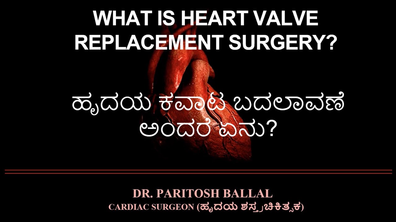What is heart valve replacement surgery(In Kannada)? ಹೃದಯ ಕವಾಟ ಬದಲಾವಣೆ