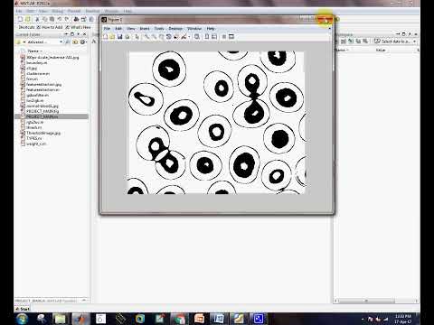DETECTION OF LEUKEMIA BY NUCLEAR SEGMENTATION - matlab phd  research