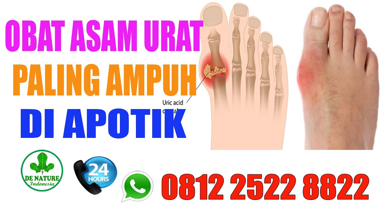 Obat Asam Urat Reumatik Paling Ampuh Di Apotik - YouTube