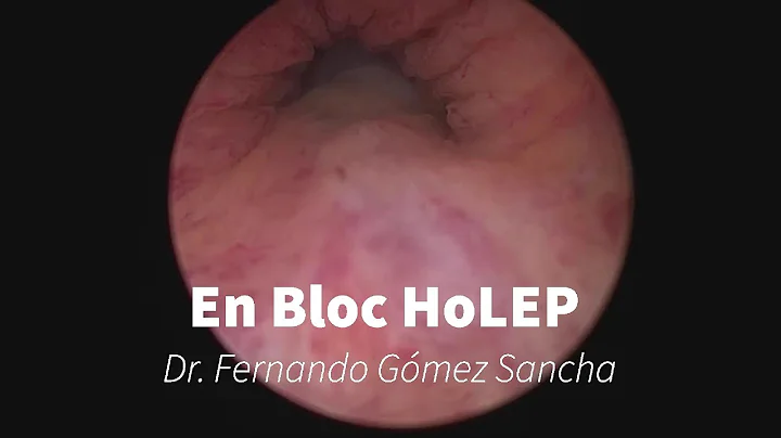 En Bloc HoLEP with early apical liberation