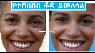 ለተሸበሸበ ቆዳ በሳይንስ የተረጋገጡ መፍትሔዎች/How to Boost your collagen  effectively. screenshot 4