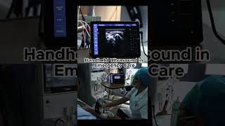 Handheld Ultrasound in Emergency Care. #HandheldUltrasound #POCUS #AIUltrasound