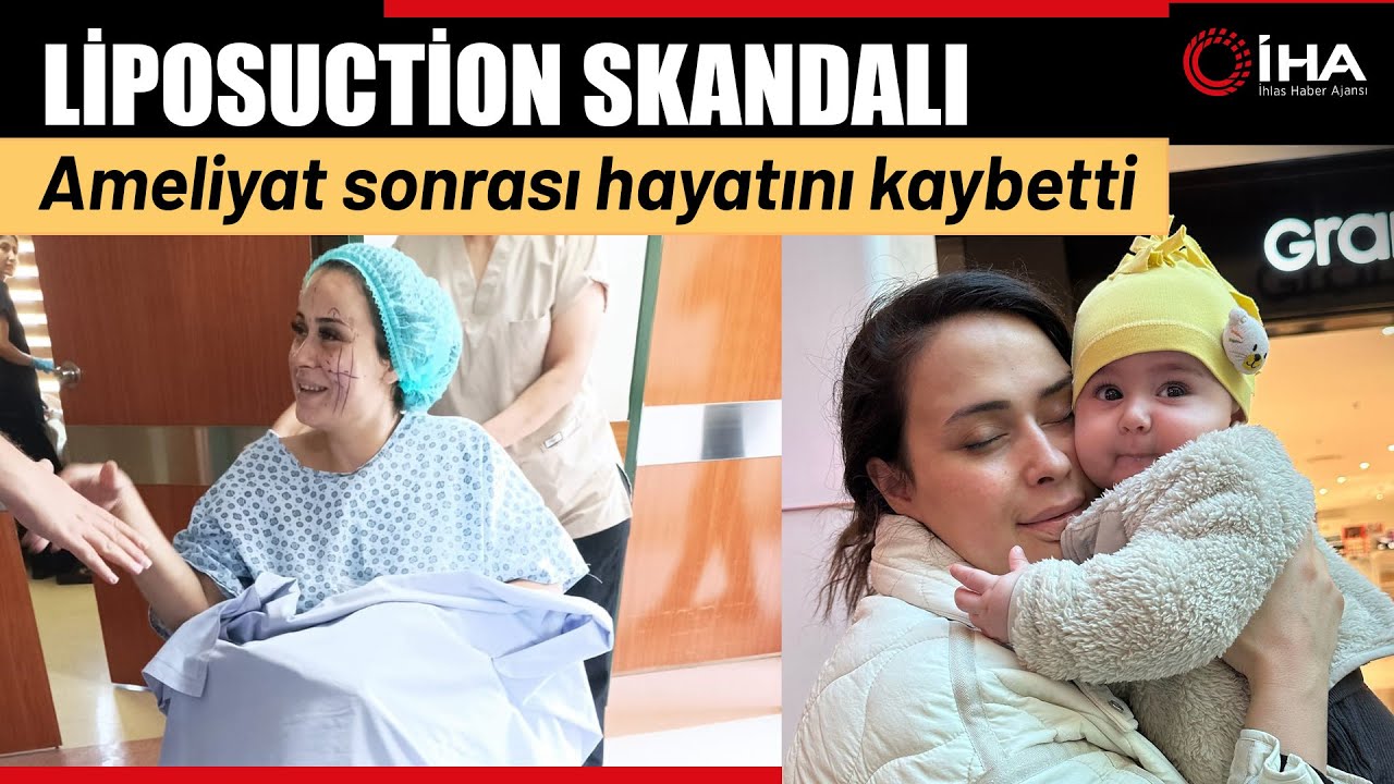Liposuction Ameliyatı İçin Gittiği Özel Hastaneden Cenazesi Çıktı