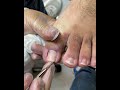Relaxing Toe Care | Neat and Gentle Nail Trim #nails