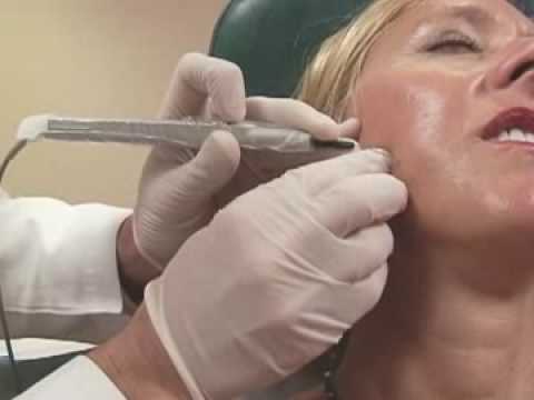 Skin Cancer Screening on Rex HealthBreak