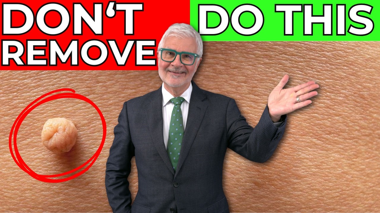 My Skin Tags Dried Up And Fell Off After I Made This One Lifestyle Change!