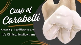 “Understanding the Cusp of Carabelli: Anatomy, Significance, and Clinical Implications”