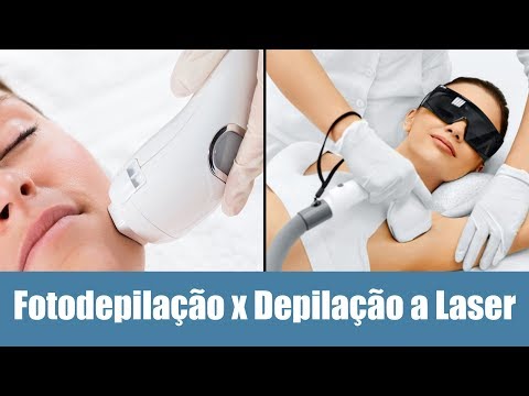 Fotodepilação x Depilação à laser - Qual é a melhor opção?