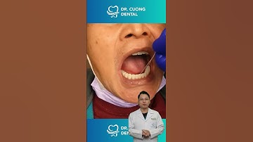 Giải pháp cho những ai mất răng hàm dưới! |Dr Cường Official