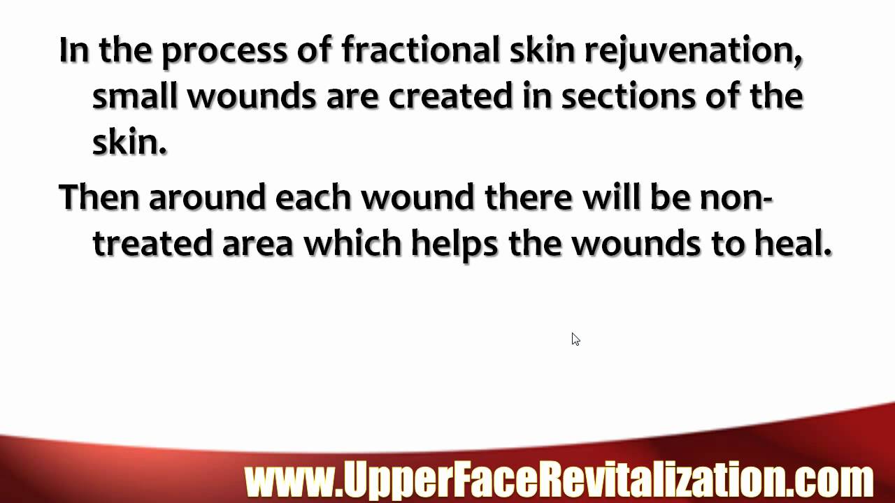 How To Tighten Neck Skin - YouTube