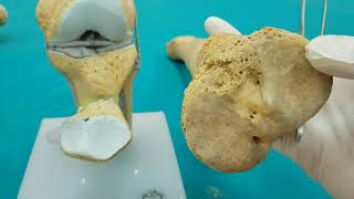Juncturae Membri Inferioris-Alt Ekstremite Eklemleri-Art.genudiz Eklemi Anatomisi 2.Bölüm
