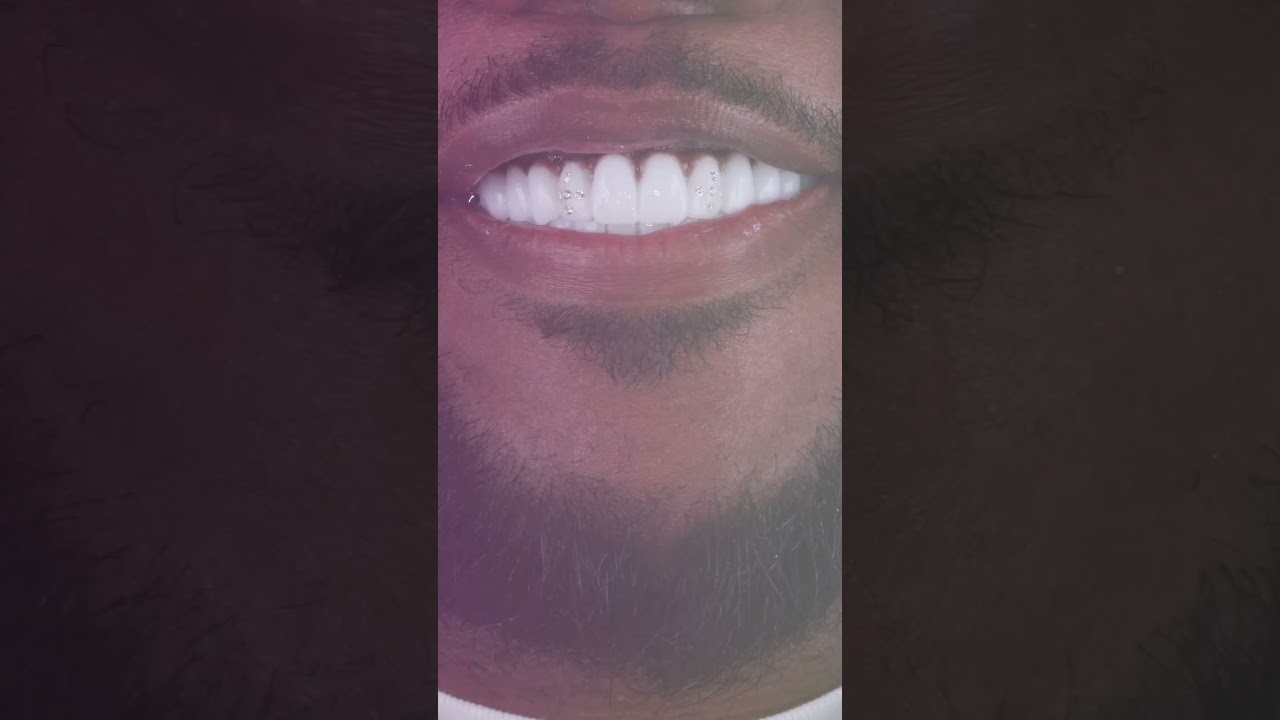 Make your smile shine with us!😉✨