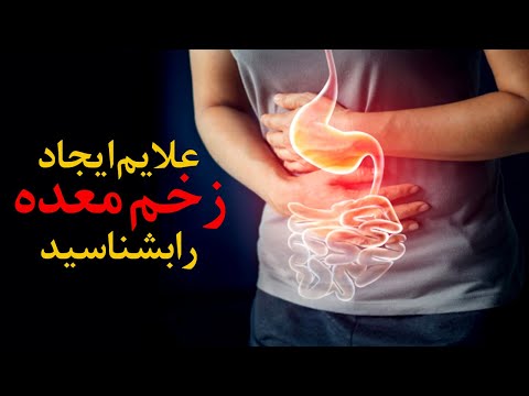 تصویری: برید چگونه ایجاد می شود؟