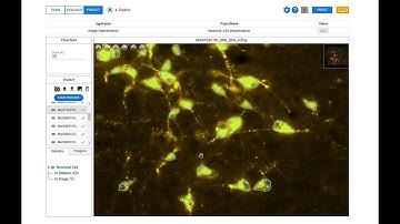 Build Neuron Segmentation AI without coding | DeepBlock.net | Deep Block | No-code | ML