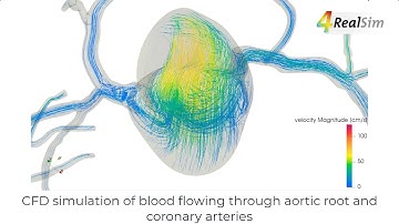 Coronary Blood Flow | 4RealSim