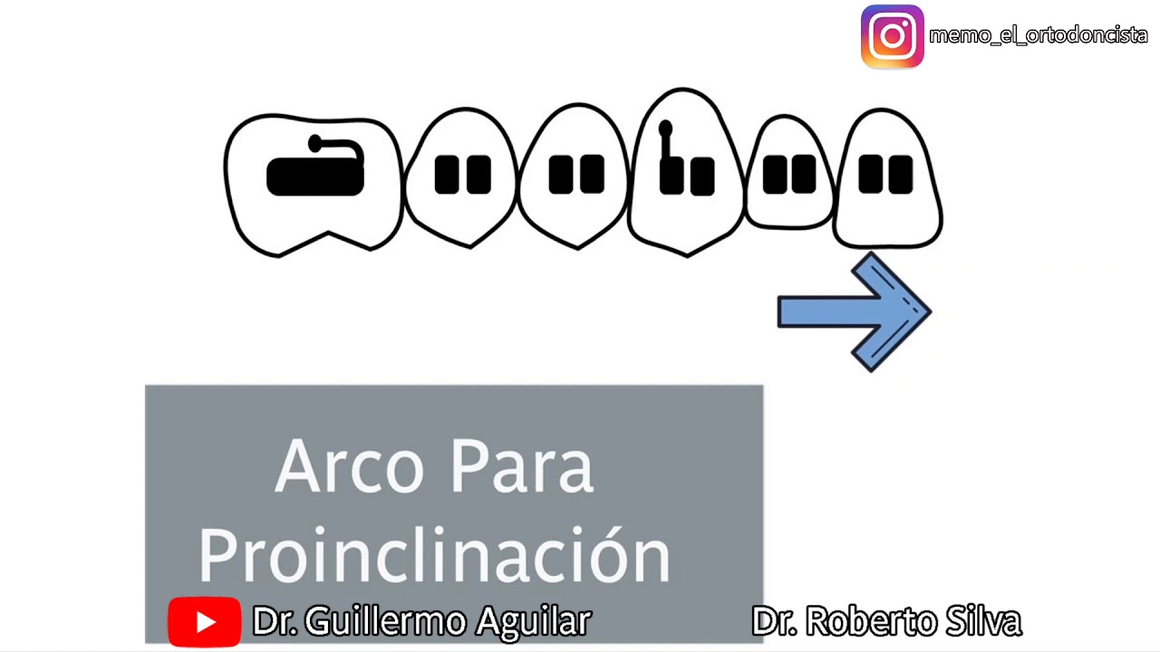 Arco Para Proinclinación