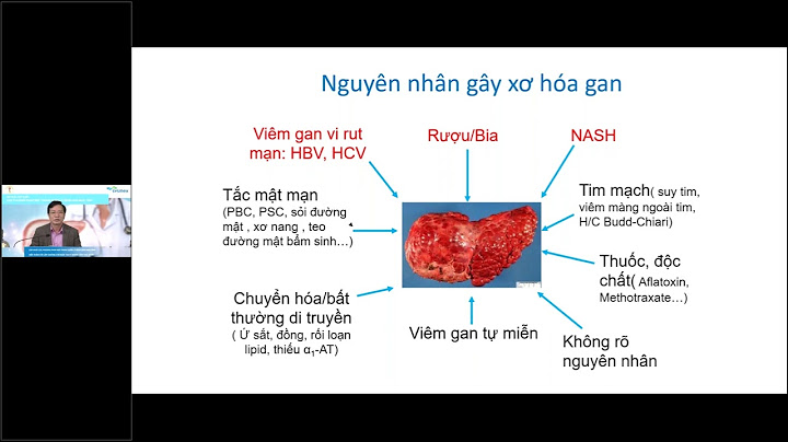 Chỉ số đánh giá xơ gan năm 2024