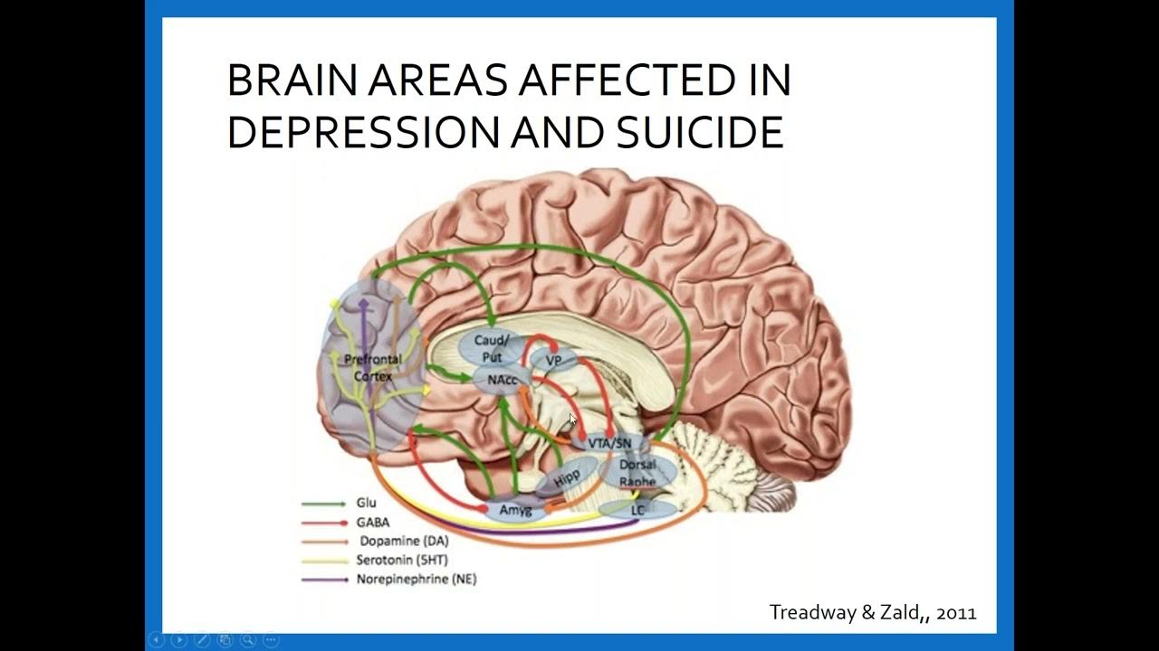 Brain 51. Brain 51