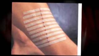 3M Steri Strip  Skin Closures, Reinforced, 1 4 x 3, 3 Pk