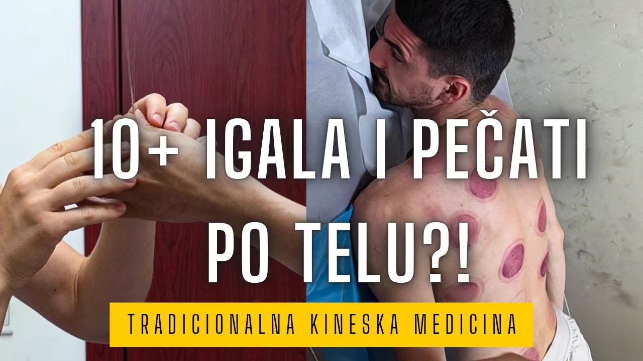 Izboli su me 10+ puta, muž mi je sav u pečatima.. Kineska medicina deluje?! A na kraju – moksibušn!