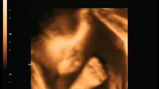 Lilly - Two Months till birth Part 2