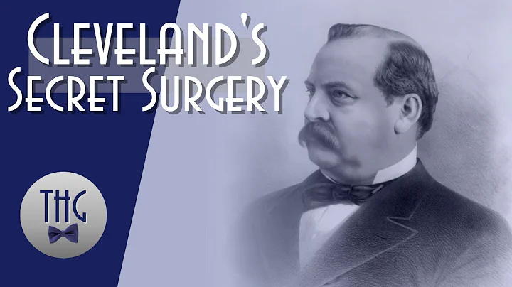 Grover Cleveland's Secret Surgery