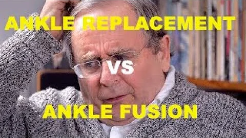 Ankle Fusion or Ankle Replacement? The best treatment for ankle arthritis.