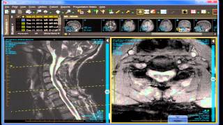 Image-Based Neurodiagnosis and Case Review