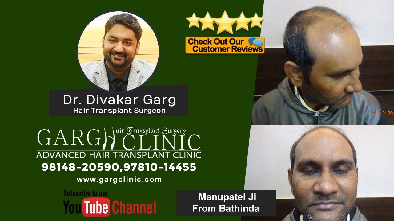 Manupatel Ji From Bathinda Honest Feedback to | #DrDivakargarg |  #gargclinic | For App +919814820590 - YouTube