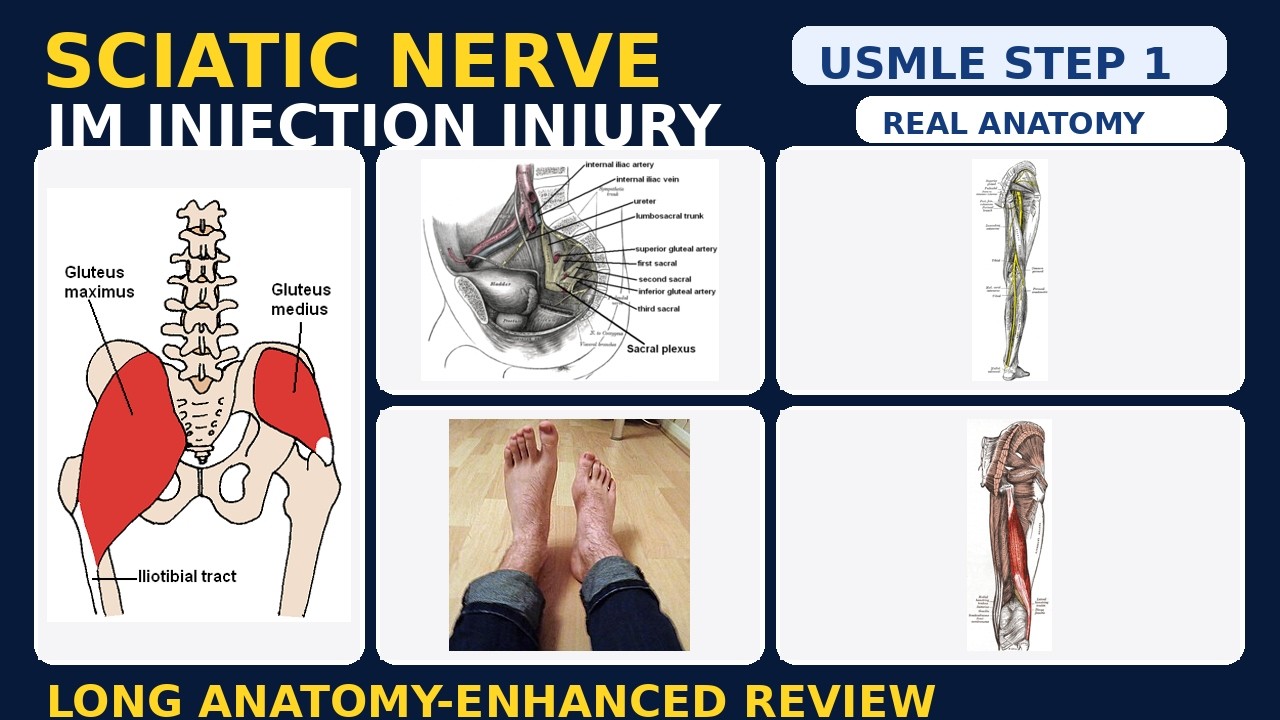 USMLE Step1 Sciatic Nerve Long Real Anatomy Review YouTube usmle-step1-sciatic-nerve-long-real-anatomy-review-youtube