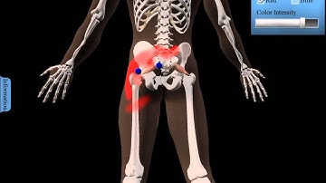 Trigger Points Demo Video