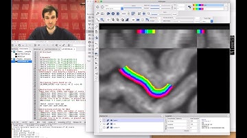 layer-fMRI analysis tutorial with BOLD and VASO