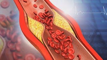 How does a blood clot form? - 3D animation