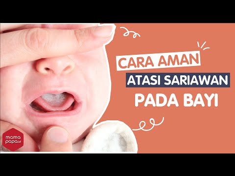 Video: Sariawan Pada Bayi Baru Lahir