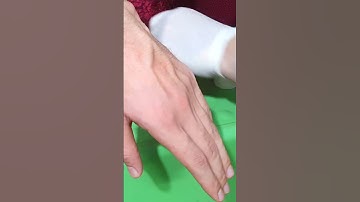 How to Insert IV Cannula | IV Cannulation Technique | Branula | Intravenous Catheter