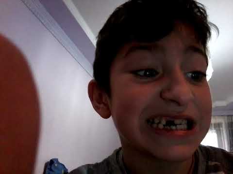 კოჭლი კაცი ვარ, ხიდან ჩამოვარდი