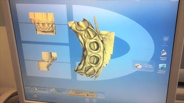 CAD CAM NEPRO Flávio Neves Biocopy