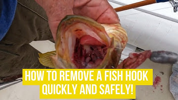 How To Remove a Fish Hook Quickly and Safely!