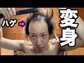 【ハゲのヘアセット術】薄毛男子の本気 髪型セットルーティン【超変化】