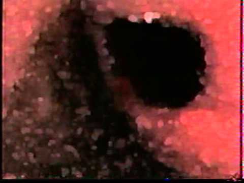 \"ფსიქოს\" ქუდი - გოგი ძოძუაშვილი, გიორგი ნადირაძე, ალმოდოვარის \"მაღალი ქუსლები\"