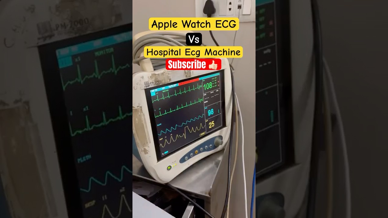 Apple Watch Series 9 ECG vs Real Hospital ECG | Accuracy Test & Comparison | 