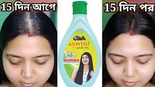 Aswini Homeo Hair Oil ব্যাবহারে ভালো মন্দ/Aswini hair oil full review/Beauty Highlighting