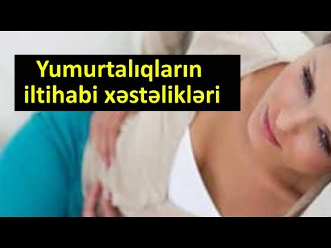 Video: Zucchini Xəstəlikləri Və Zərərvericiləri (19 şəkil): Təsviri. Zucchini Açıq Sahədə Müalicə üsulları. Yarpaqlarda Ağ çiçəklərlə Mübarizə. Çürük Yumurtalıqları Necə Müalicə Etmək Ola